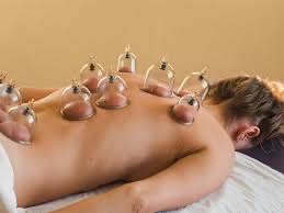 Cupping Therapy & Massage