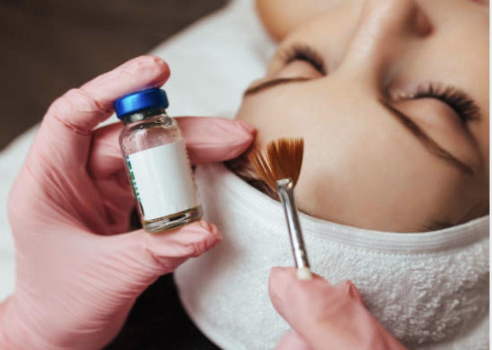 Chemical Peel [ Level II ]