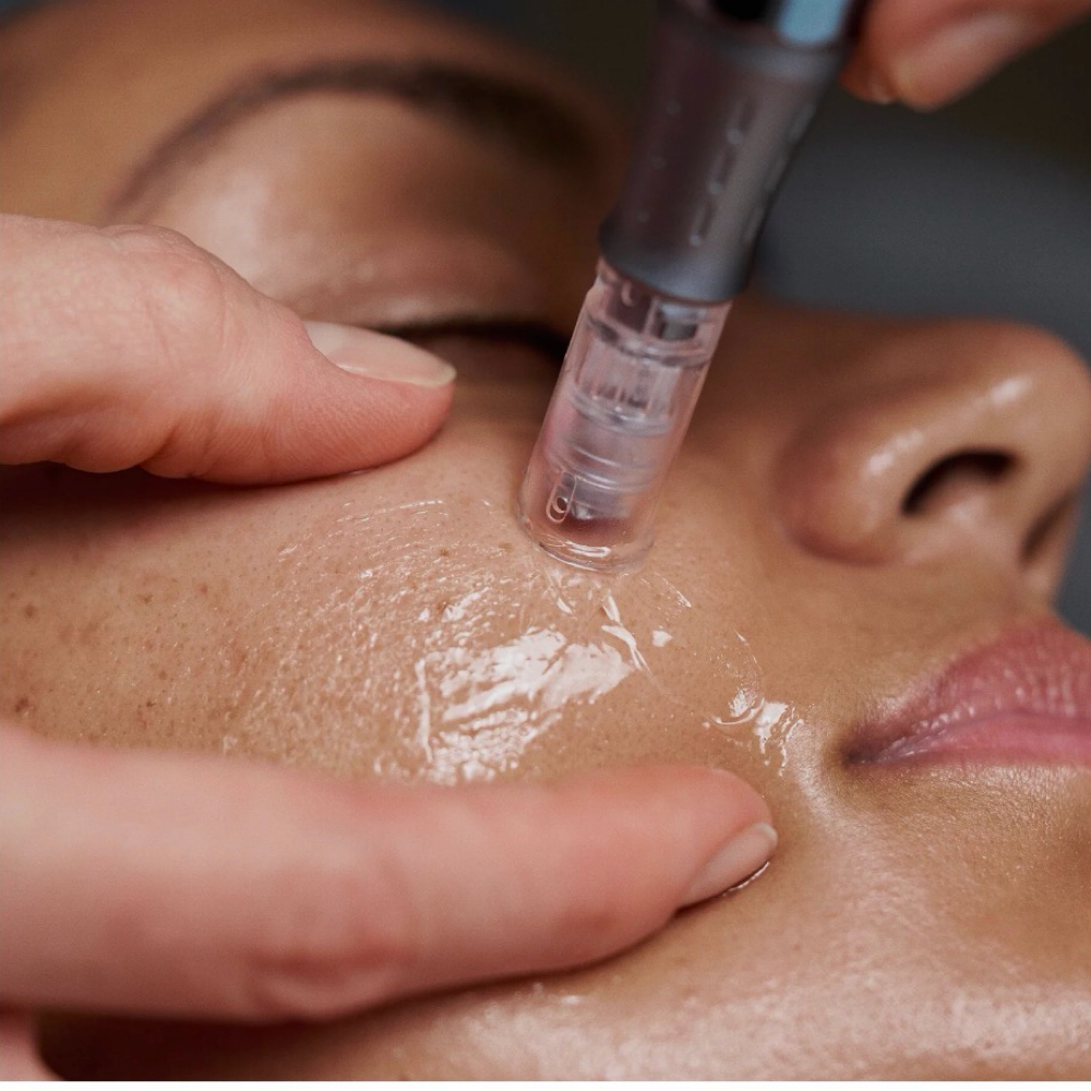 Nano Infusion Add On at Skin-Centric in San Antonio, TX