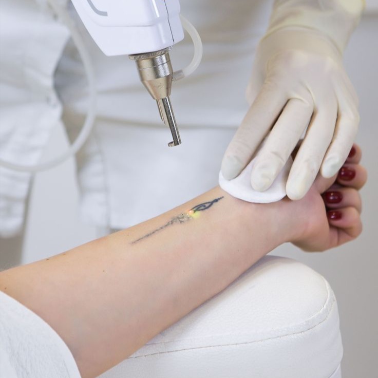 Tattoo Reducting Class $1350 at All in one beauti and Training studio in Brooklyn, NY