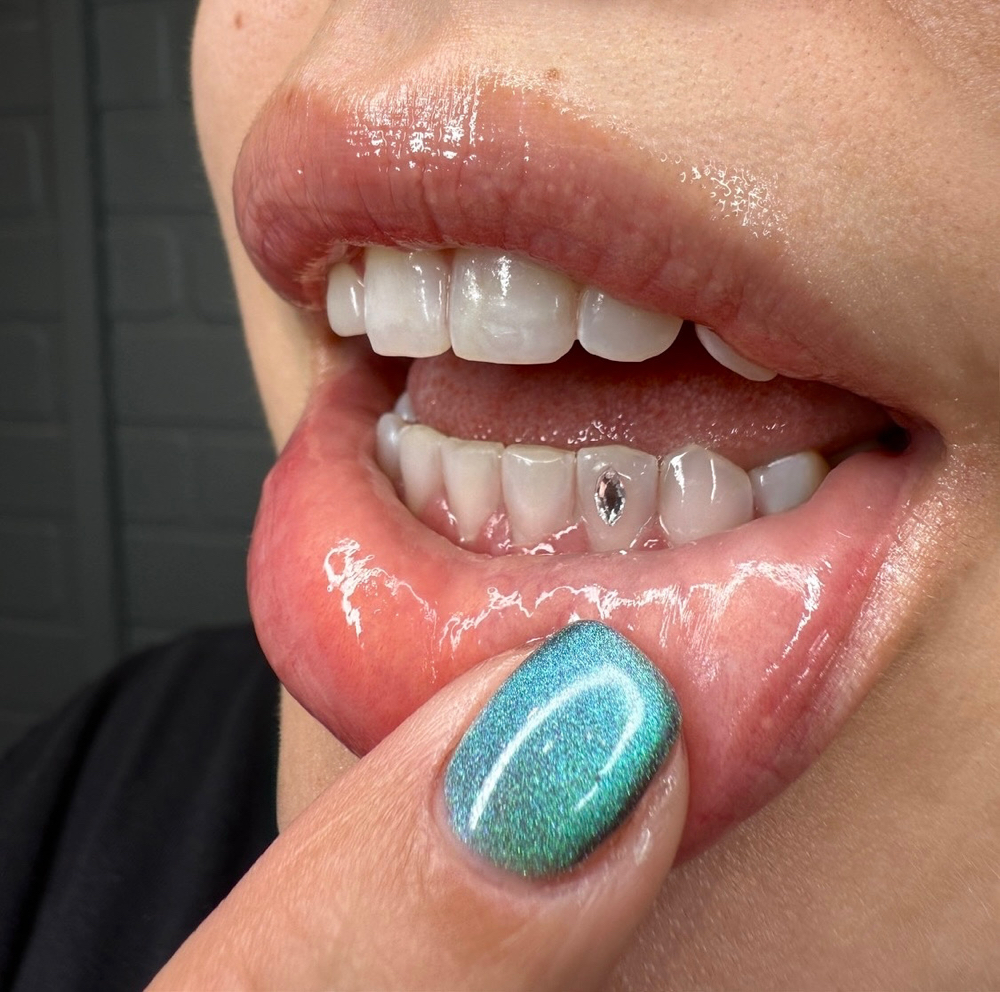 TOOTH GEMS