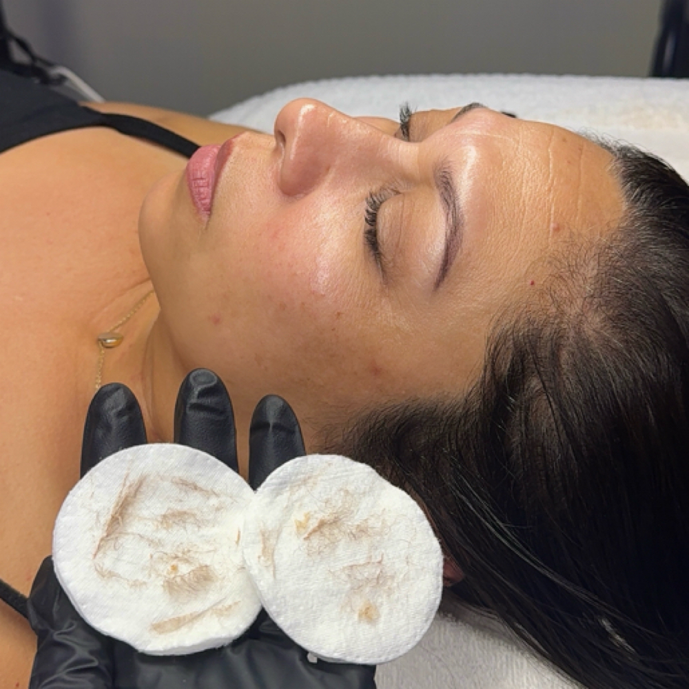 Dermaplane Facial at Bare Reflections Studio in Tulare, CA