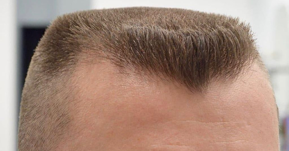 Flat Top