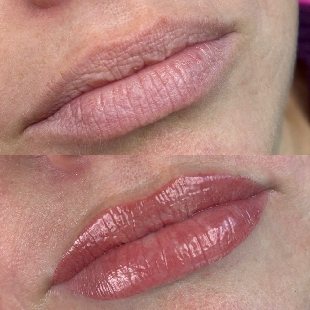 Lip Blushing