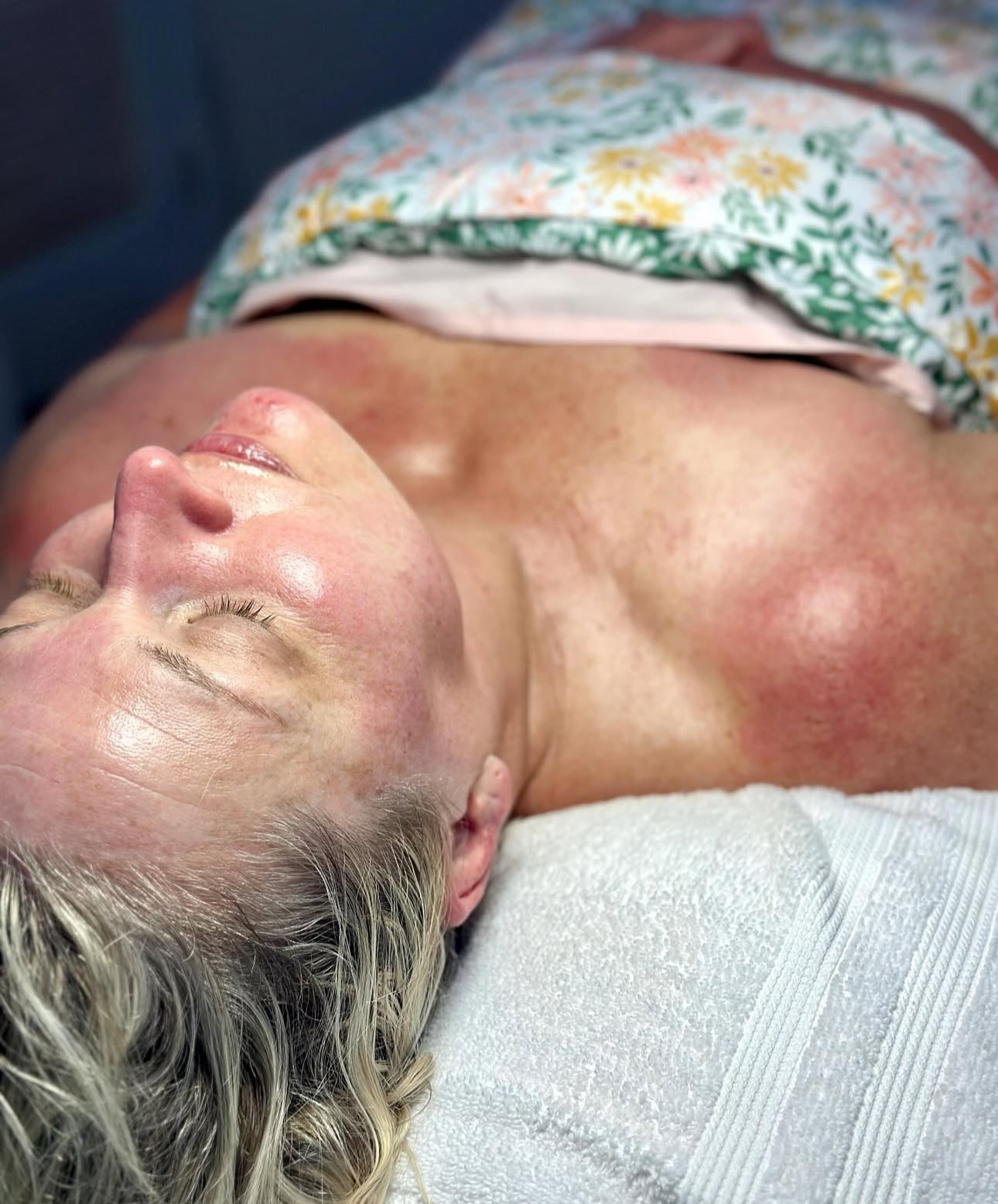 Custom Facial