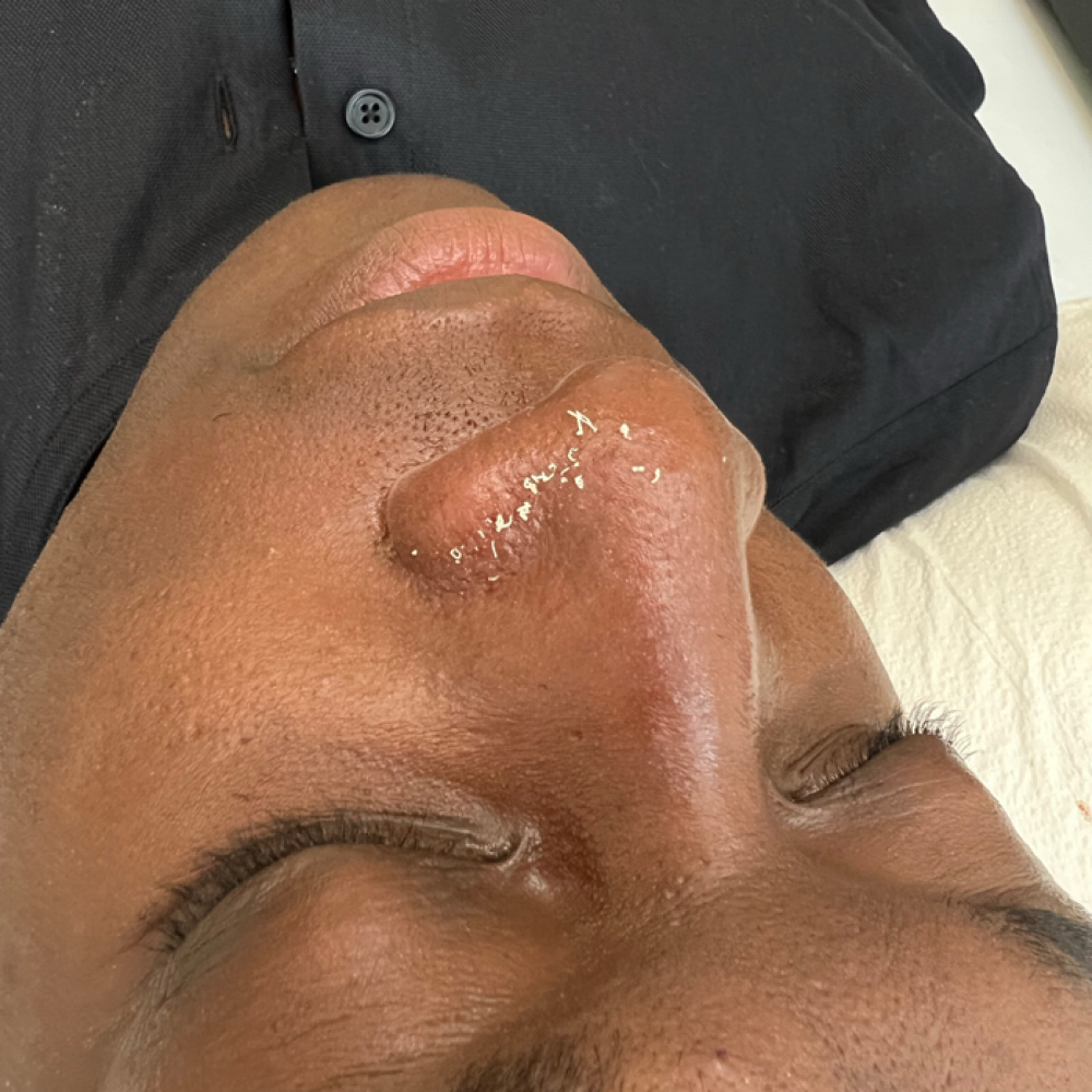 Deep Pore Facial