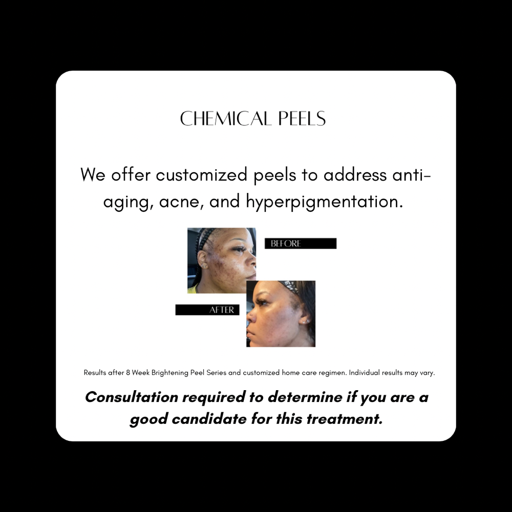 Chemical Peels (CONSULTATION REQ.)