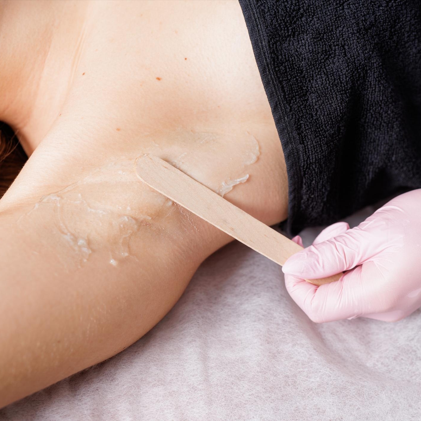 Underarms at Simply Aesthetics in Round Rock, TX