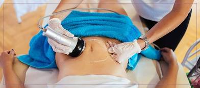 Laser Lipo + Cavitation