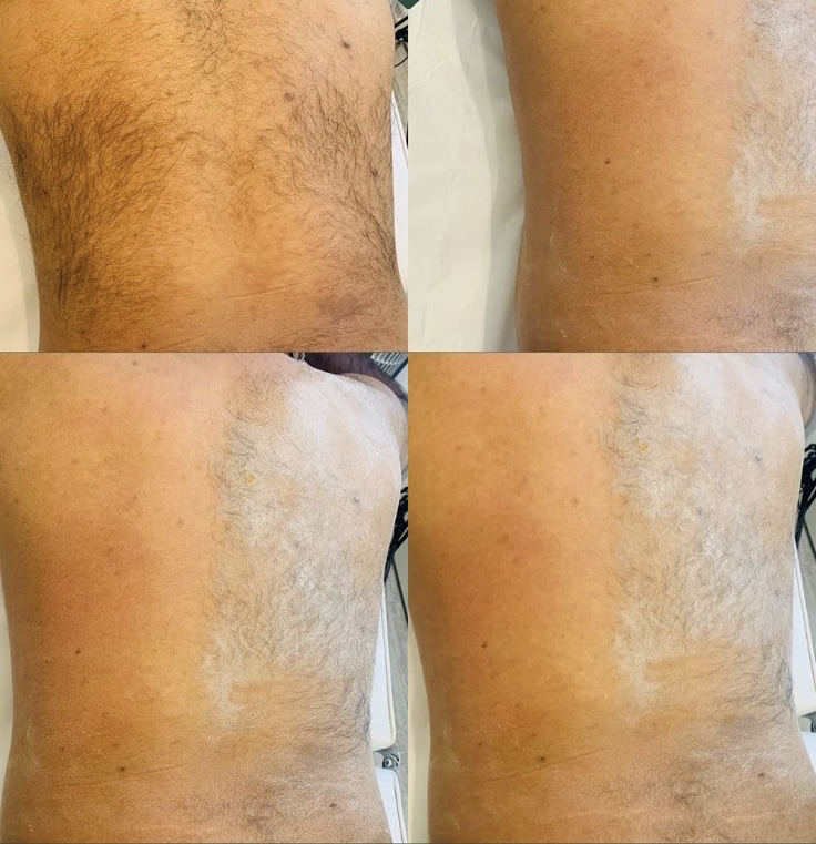 Back Wax