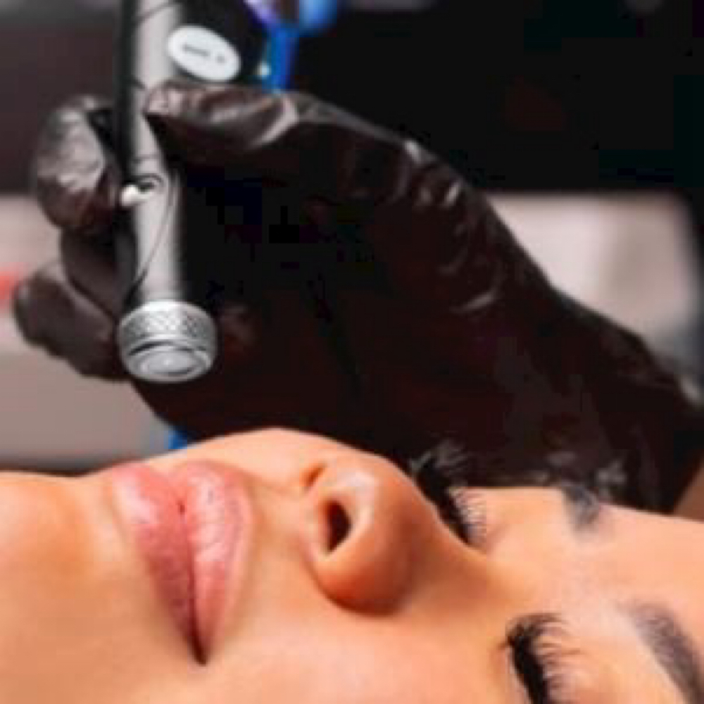 Diamond Hydrafacial at Estetica Venice