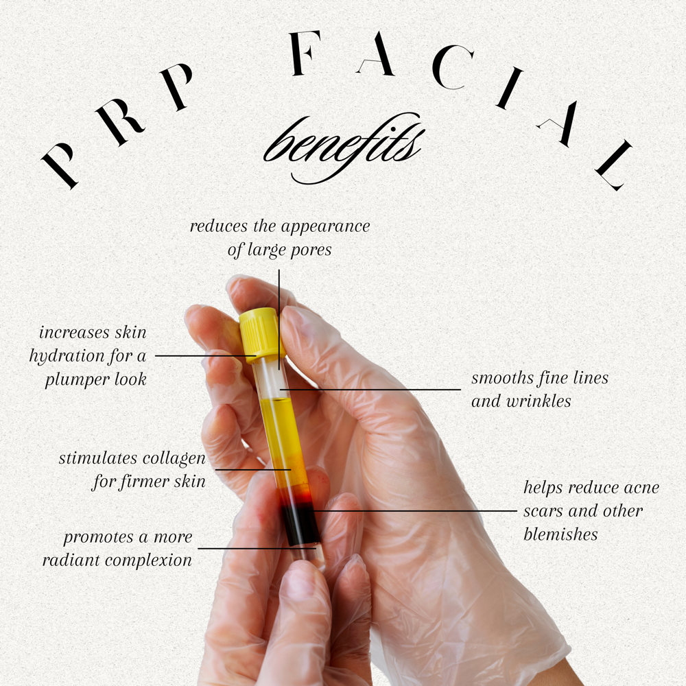 PRP Facial