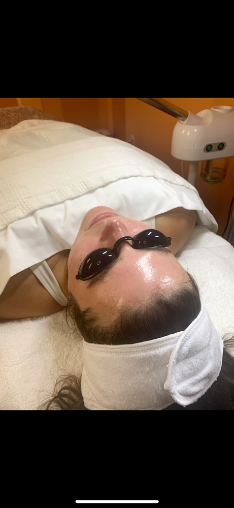 Dermaplane + Peel