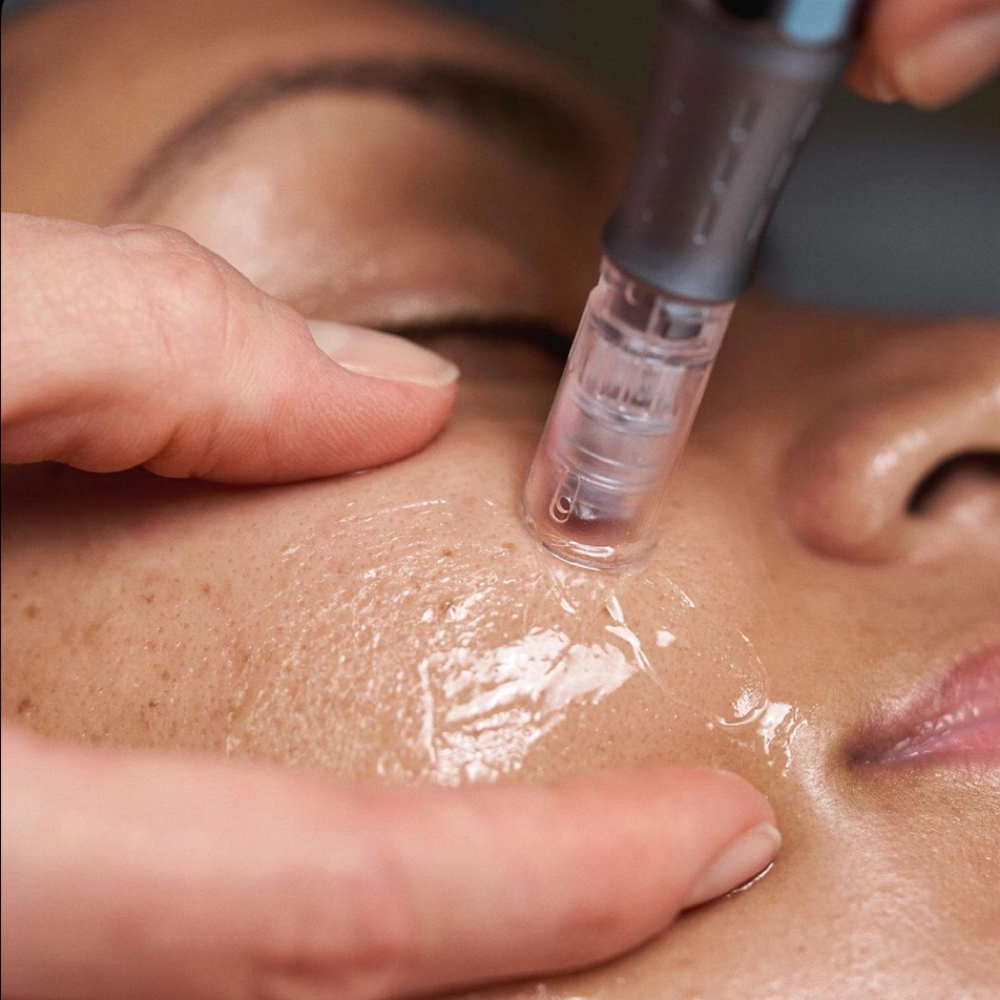 Nano Glow Renewal Facial at Skin by Lay in Houston, TX