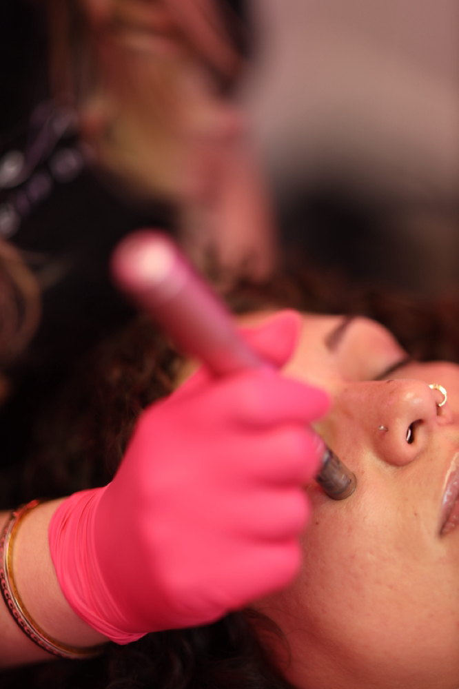 Nano Needling