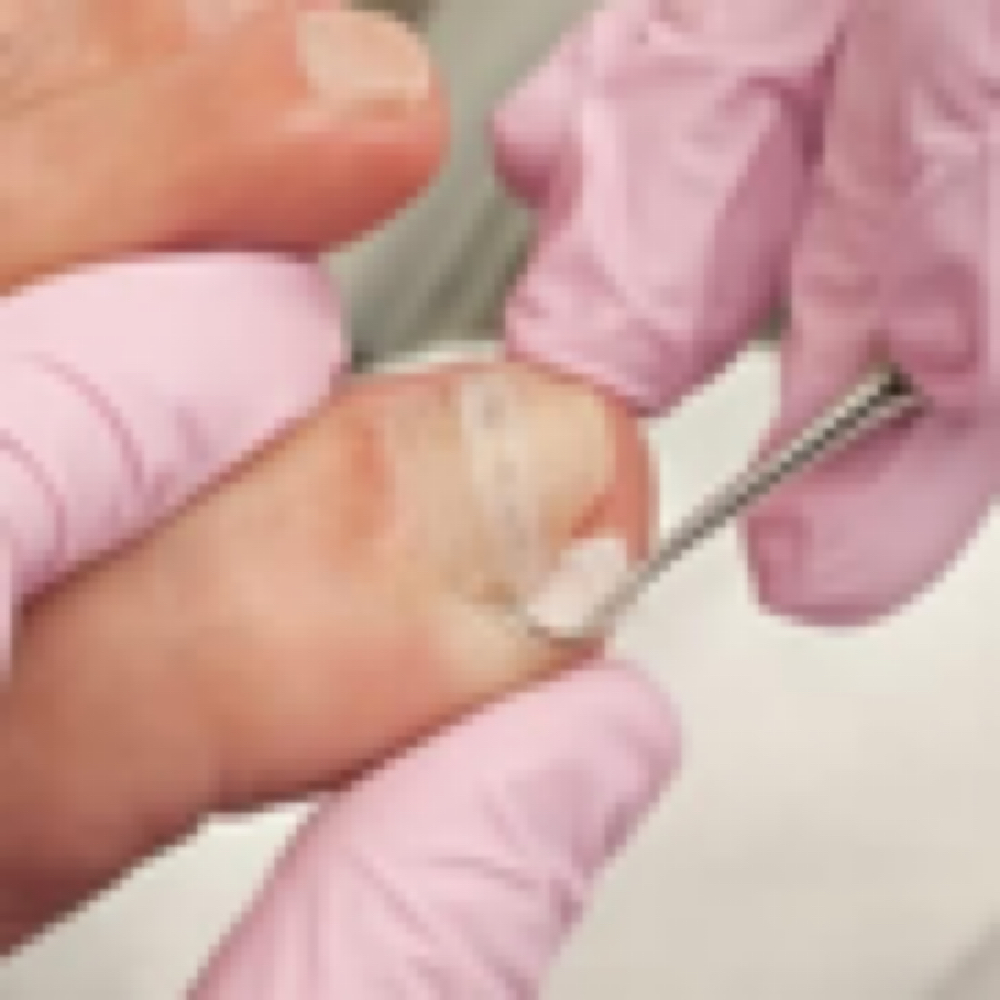 Repair- Ingrown Nail at 7 1 8 Beauty Bar in Hoboken, NJ