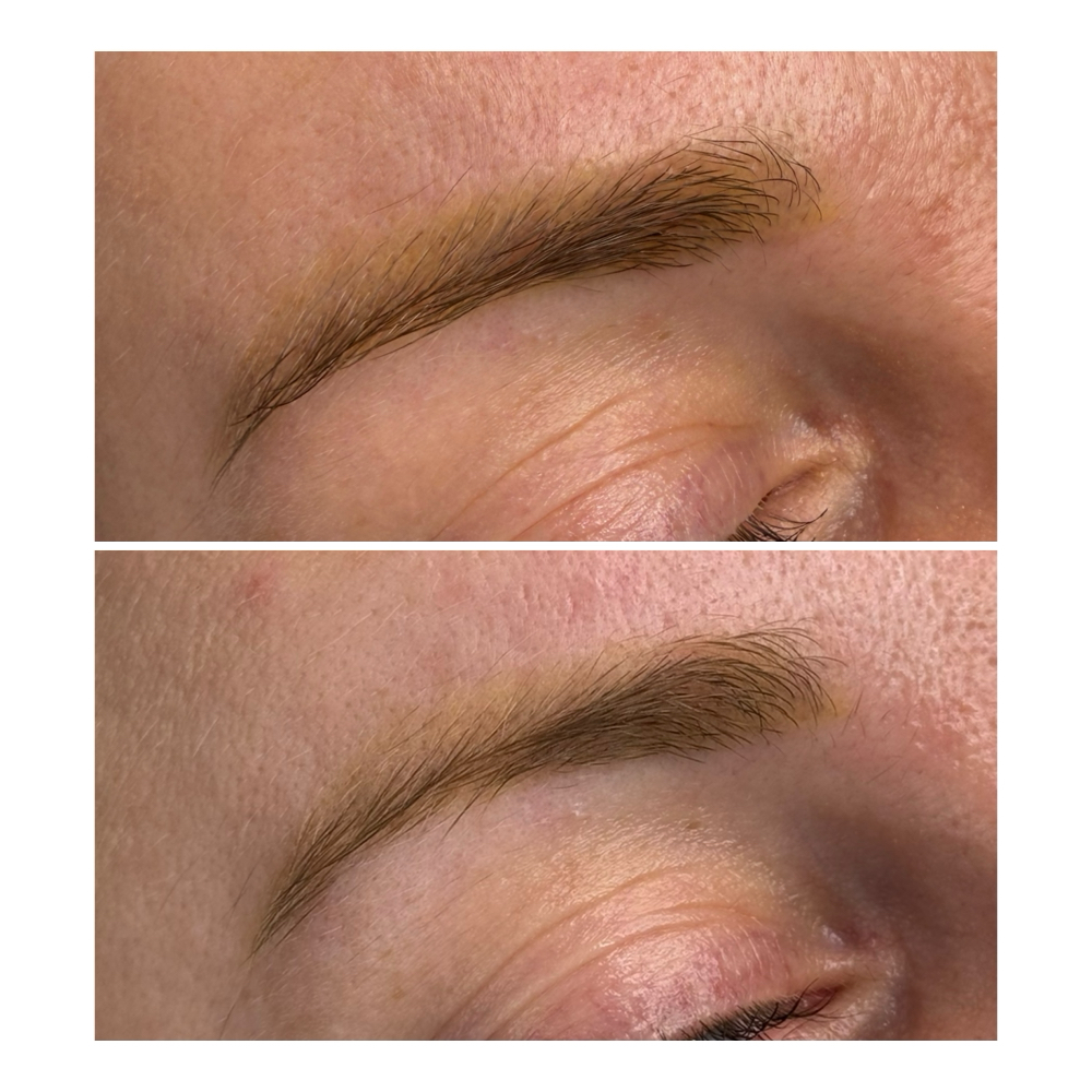 PM Removal/Saline Remover/Brow&Lips