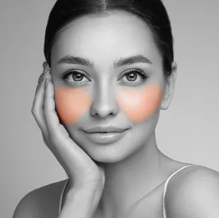 Cheeks-One Session