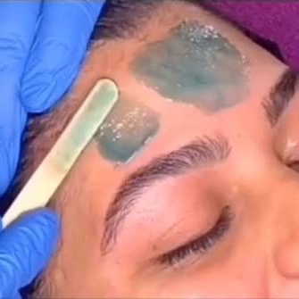 Forehead at Aura Aesthetics in Houston, TX