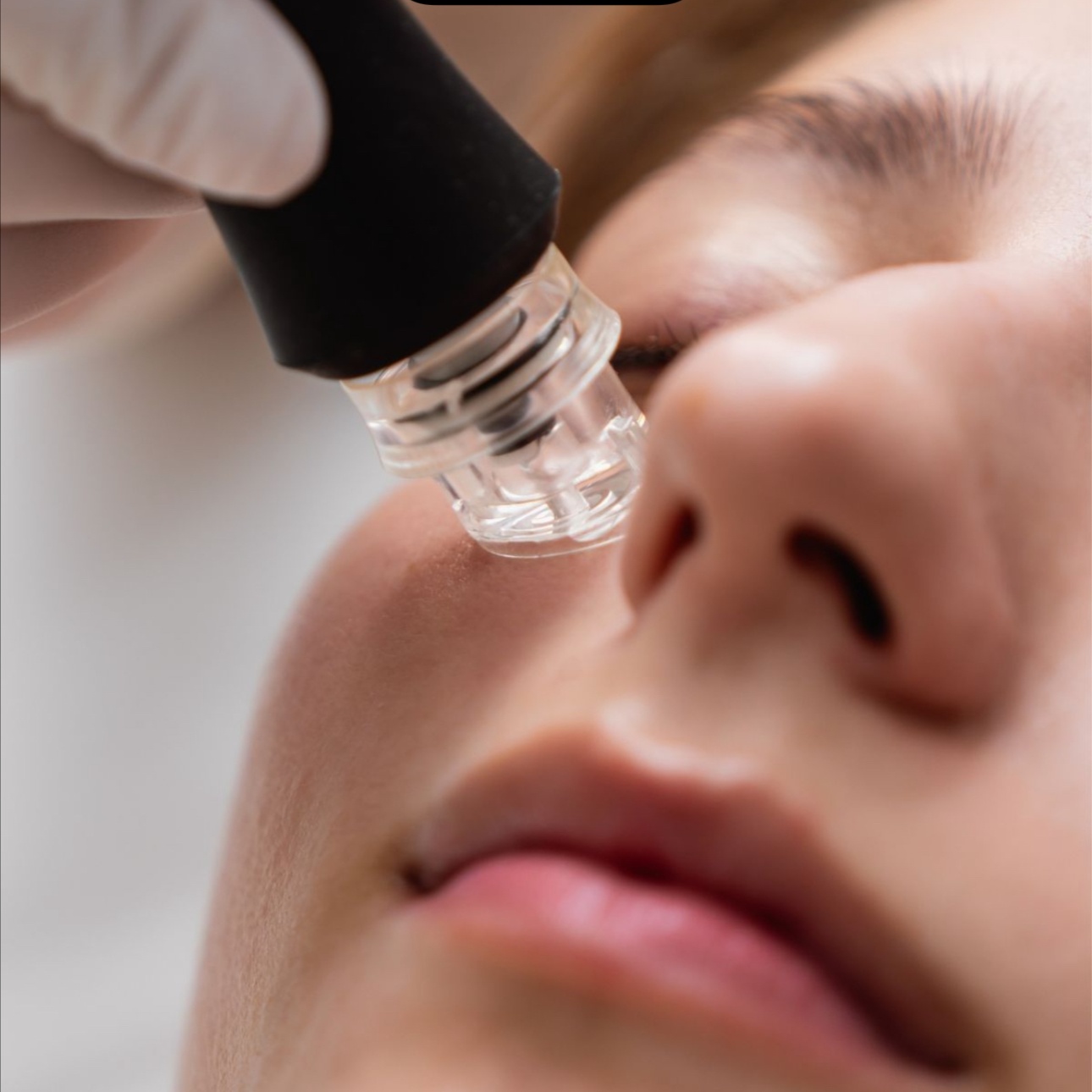 Hydra Facial at Anastacia Beauty Lounge in Lake Park, FL