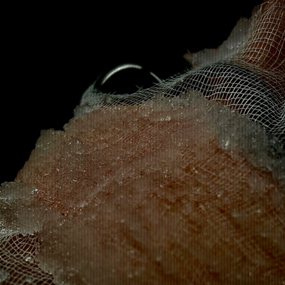 Ice Infusion Facial at MySkin Aesthetics in Laredo, TX