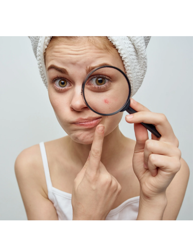 ZO Acne Facial