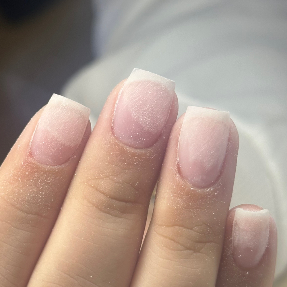 Acrylic Overlay