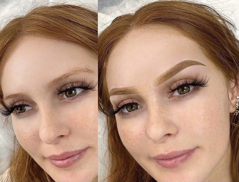 AFTER 4-6 WEEKS TOUCH UP