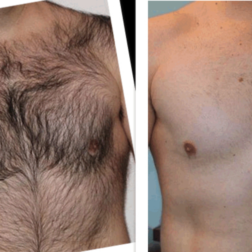 Men's Full Chest Wax at BELLA'S SENSES SPA by Angie in Coral Springs, FL