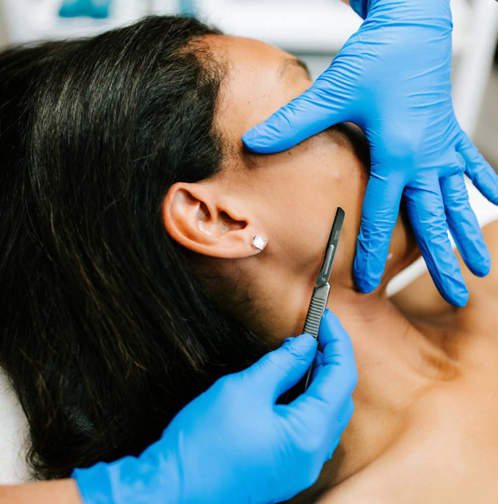 Dermaplaning (ADD ON)
