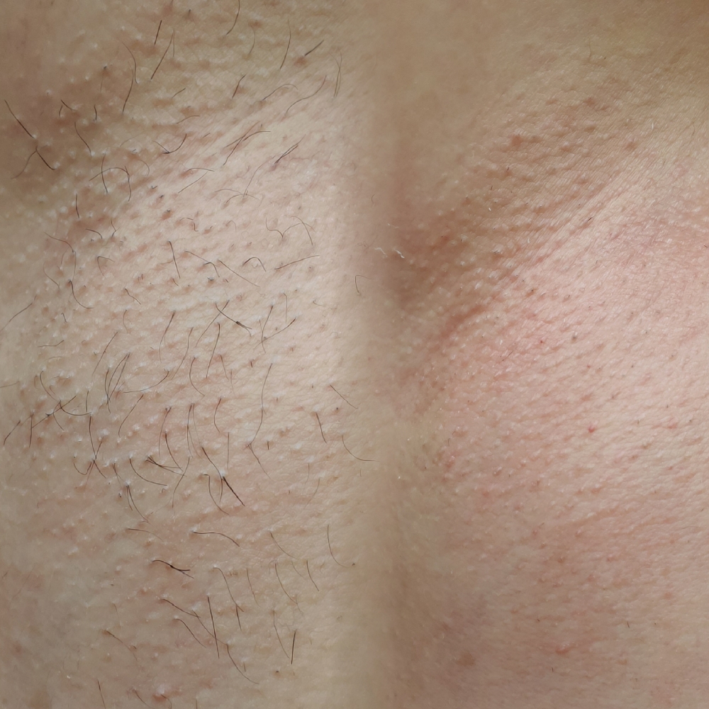 Armpit Wax