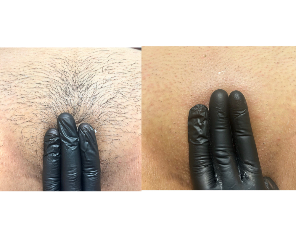 Brazilian (First Time)