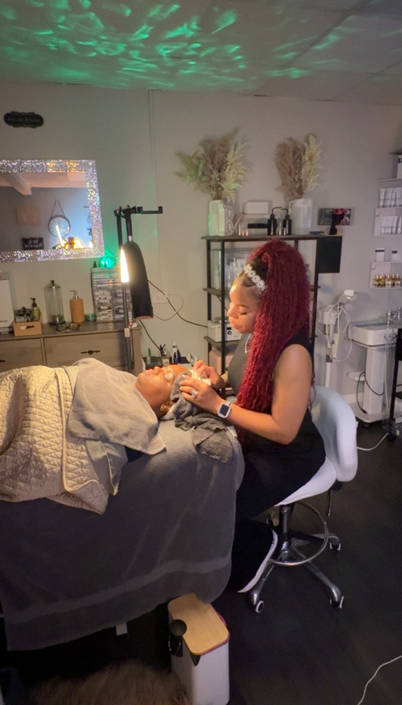 HYPERPIGMENTATION mini