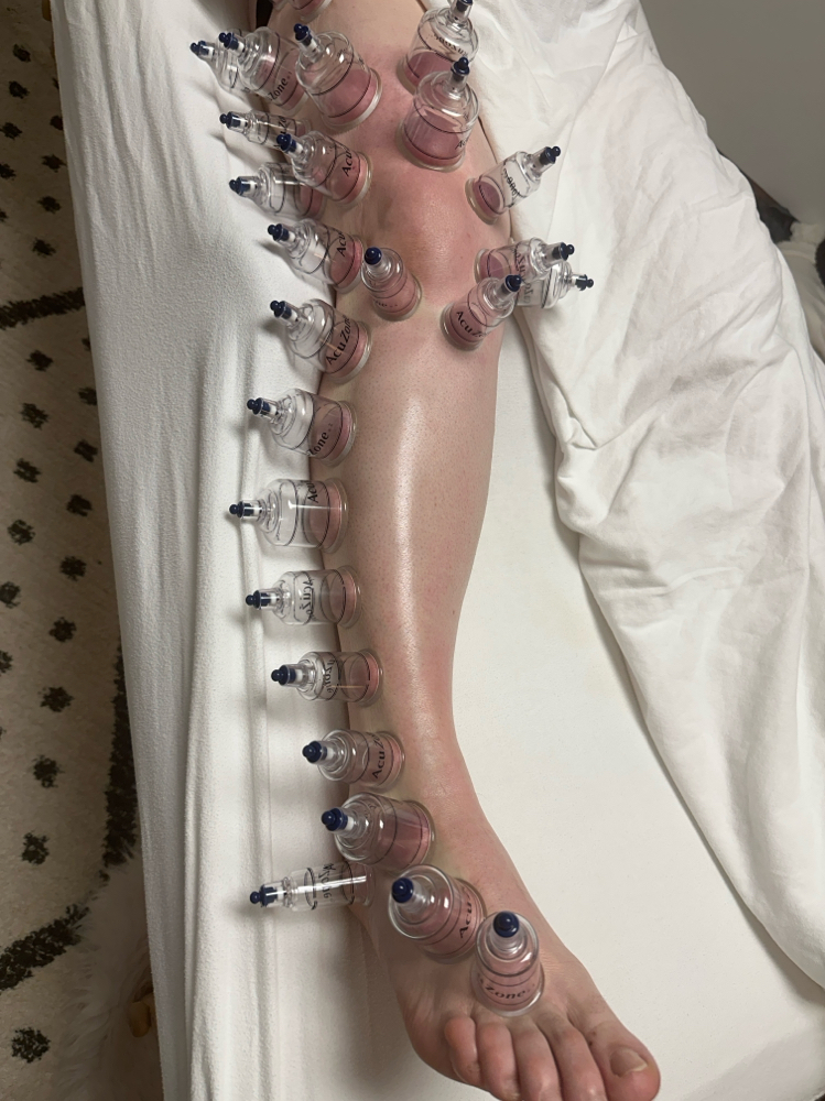 45 Minute Cupping Body Treatment
