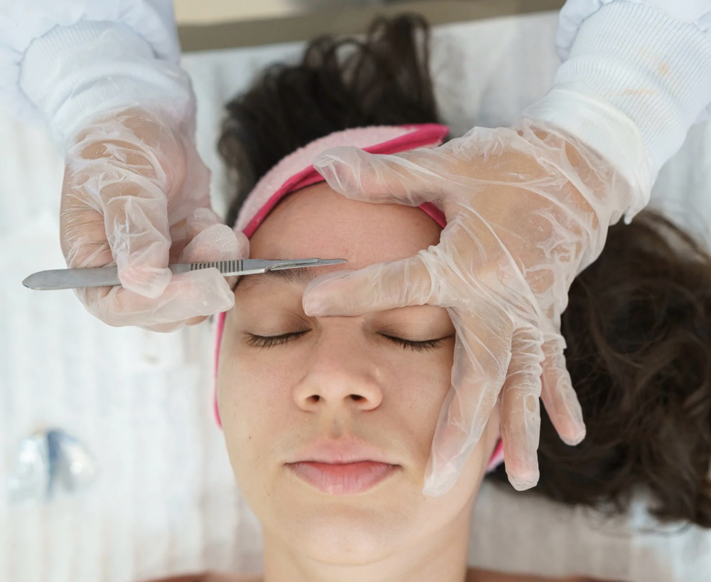 Dermaplaning Model Experience