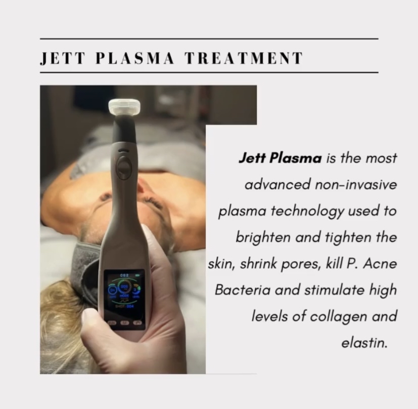 Jet Plasma