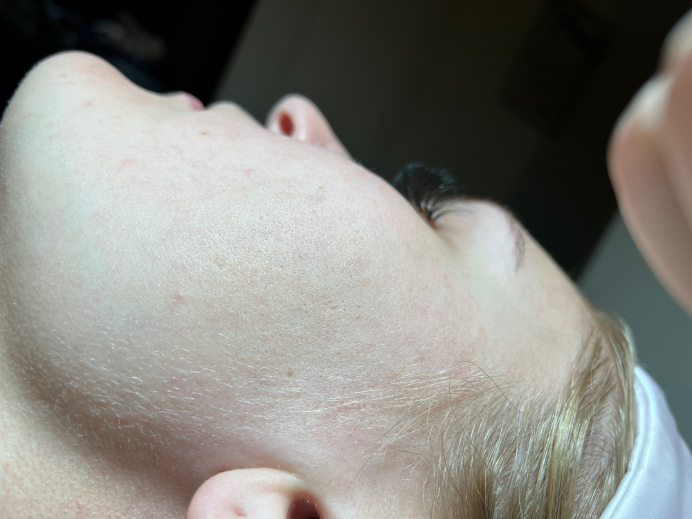 Dermaplane Facial at Current Beauty in Chandler, AZ