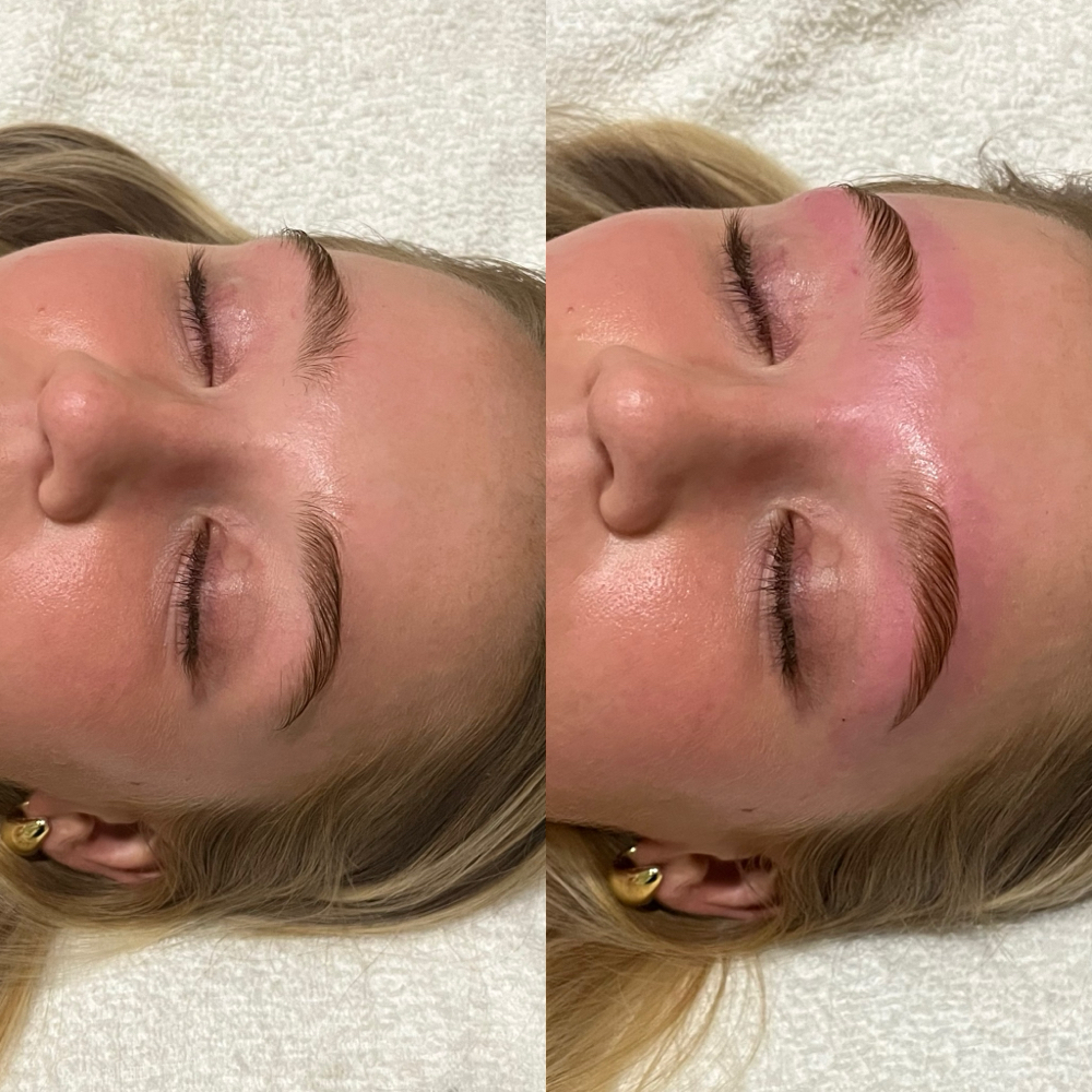 Brow Lamination