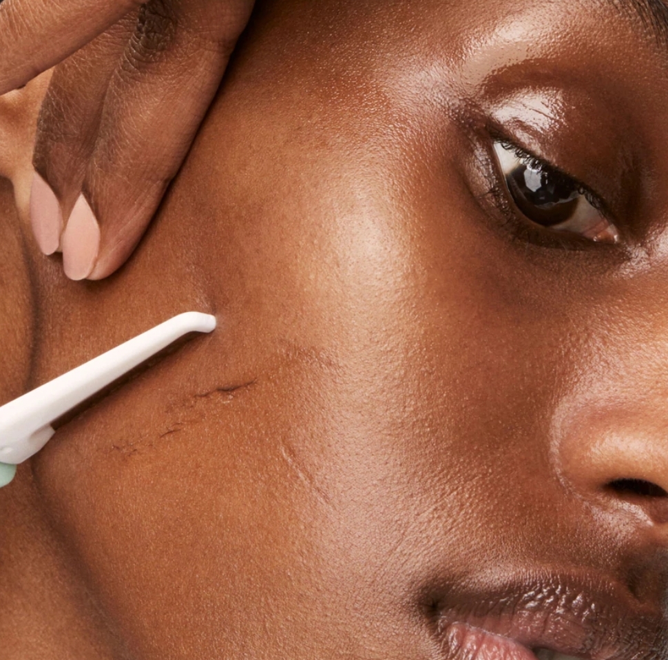 Dermaplanning (Add On) at Beat-iFul Aesthetics in Hollywood, FL