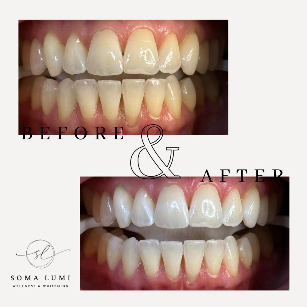 Personalized Smile Enhancement
