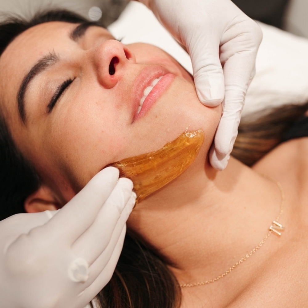Chin, Lip, Cheeks at Lunar Esthetics in Fallon, NV