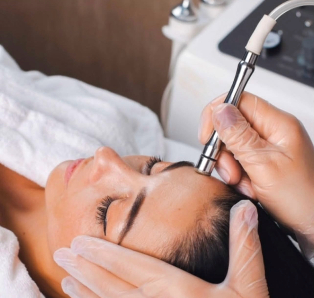 ADD ON: MICRODERMABRASION