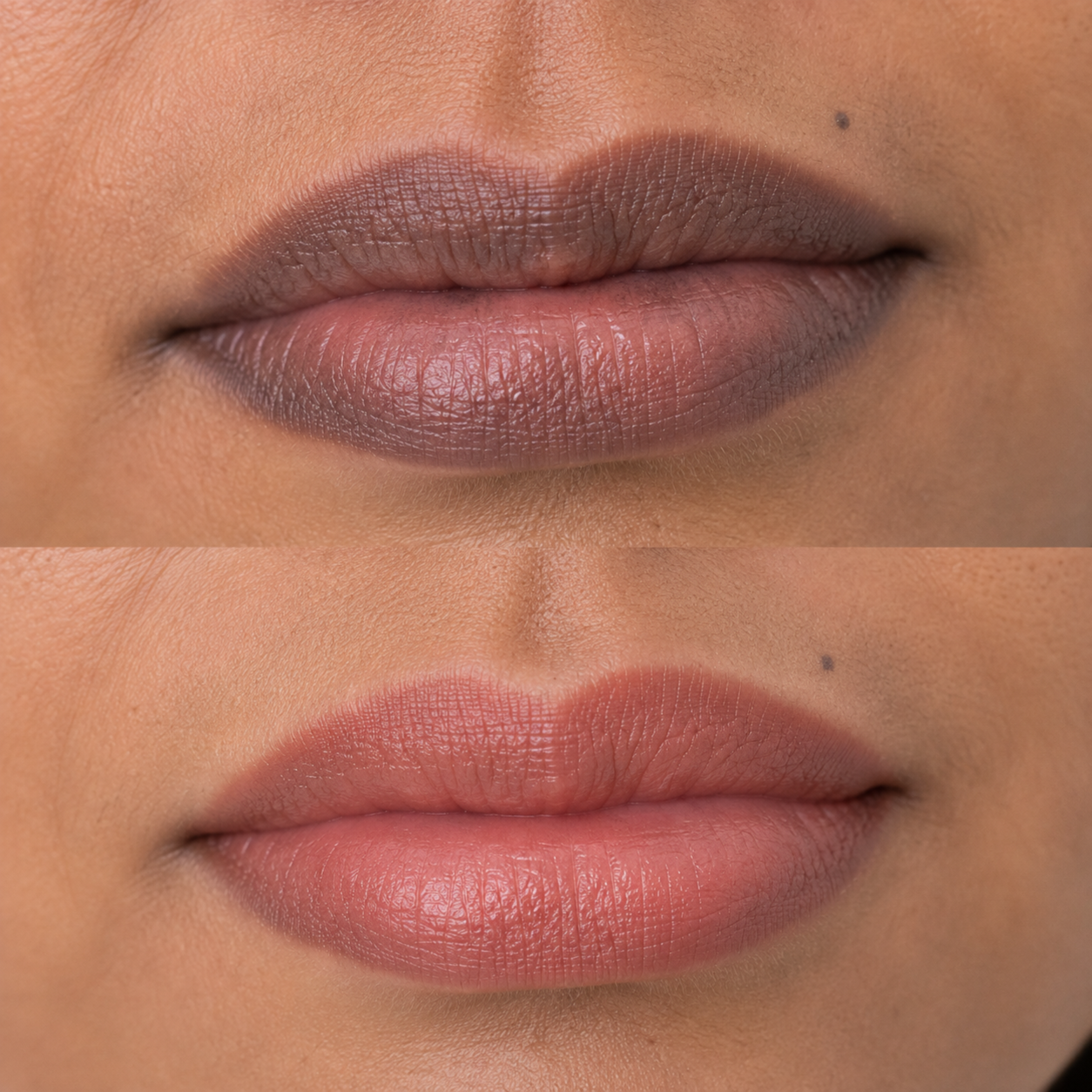 Dark Lip Neutralization at Candy Bernal Brows in Moorestown, NJ