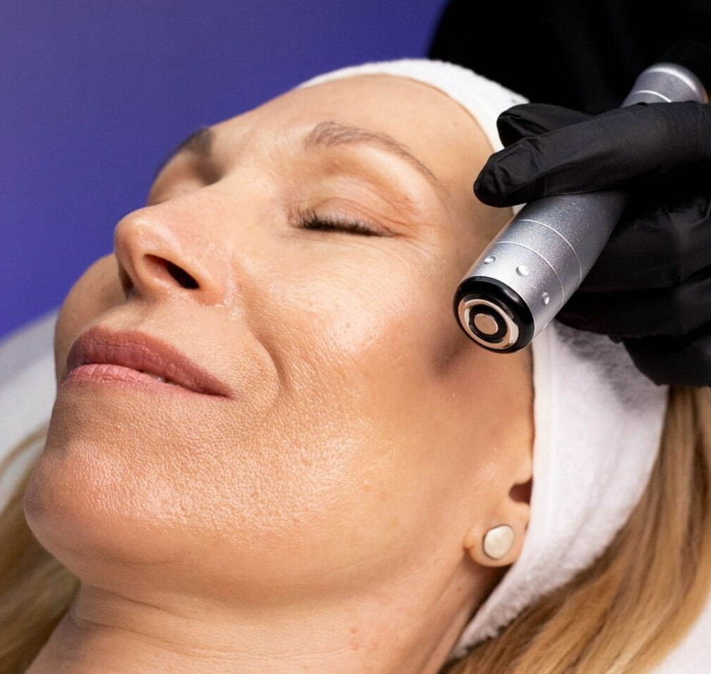 RF Under Eye Cavitation