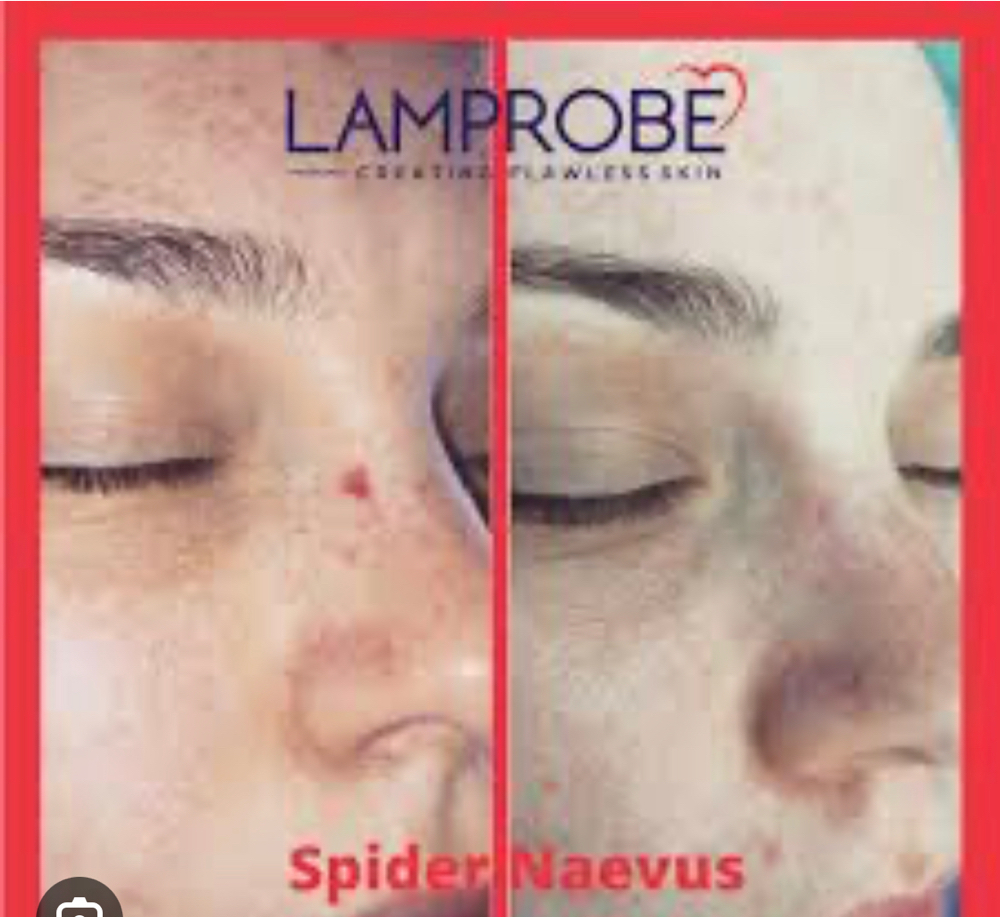 Lam Probe