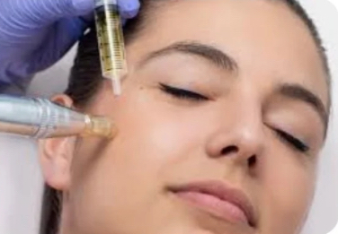 Microneedling Facial / Microguja