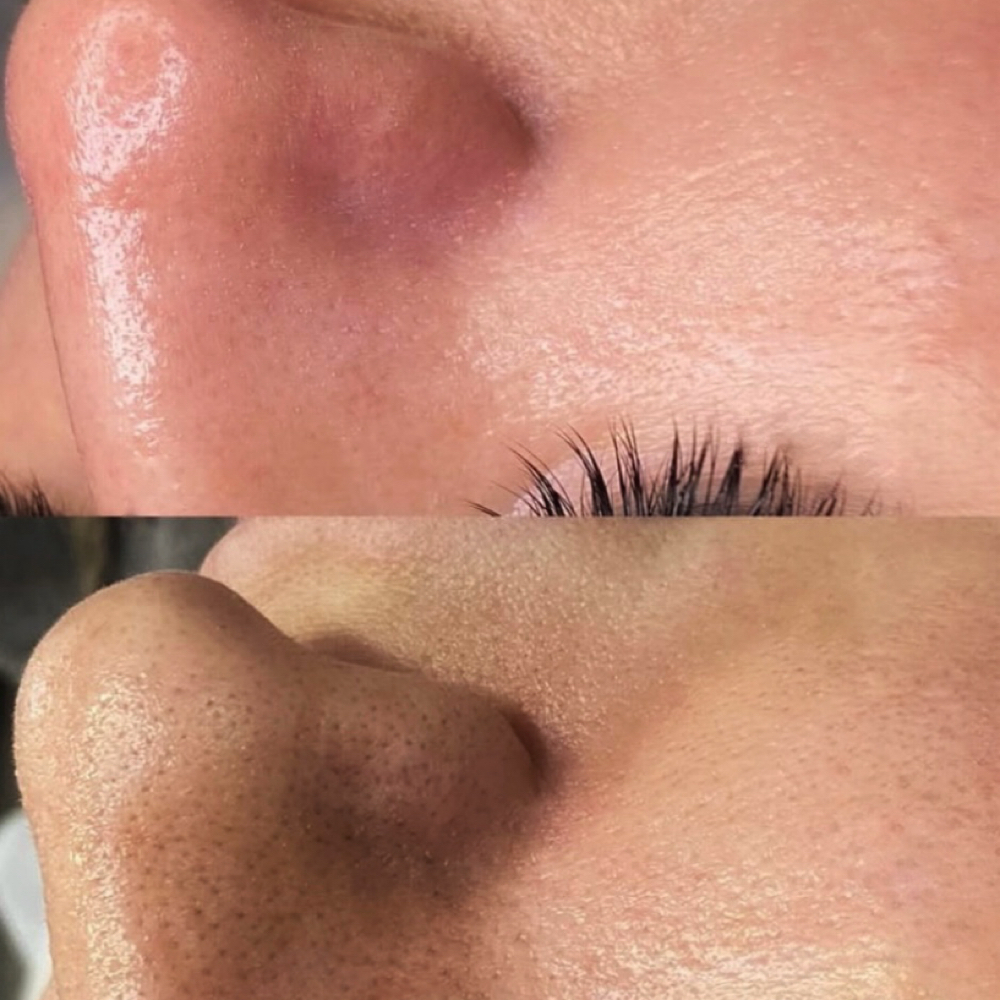 Deep Glow Facial at Navinna Studio in Philadelphia, PA