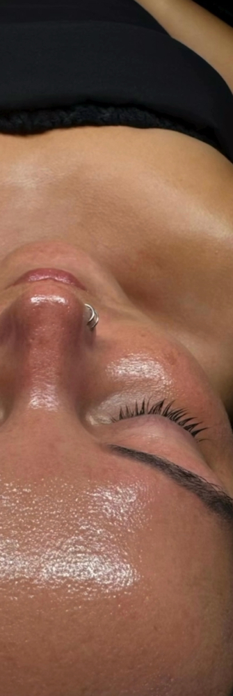 Chemical Peel Series