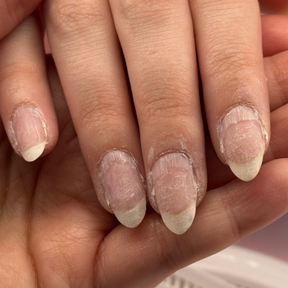Soak Off at Nailsbytess in Louisville, OH