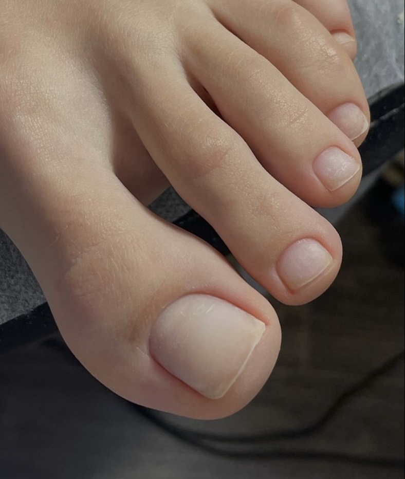Dry pedicure